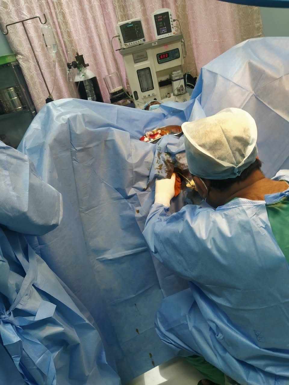 Surgeon operating with the patient on full anaesthesia monitoring